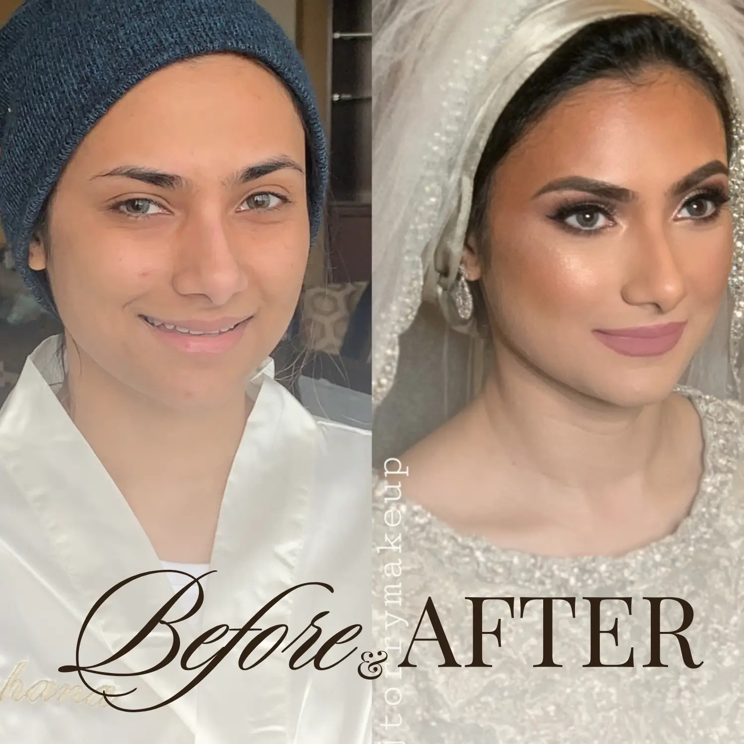 Before and after