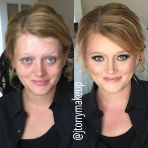 before-after-21